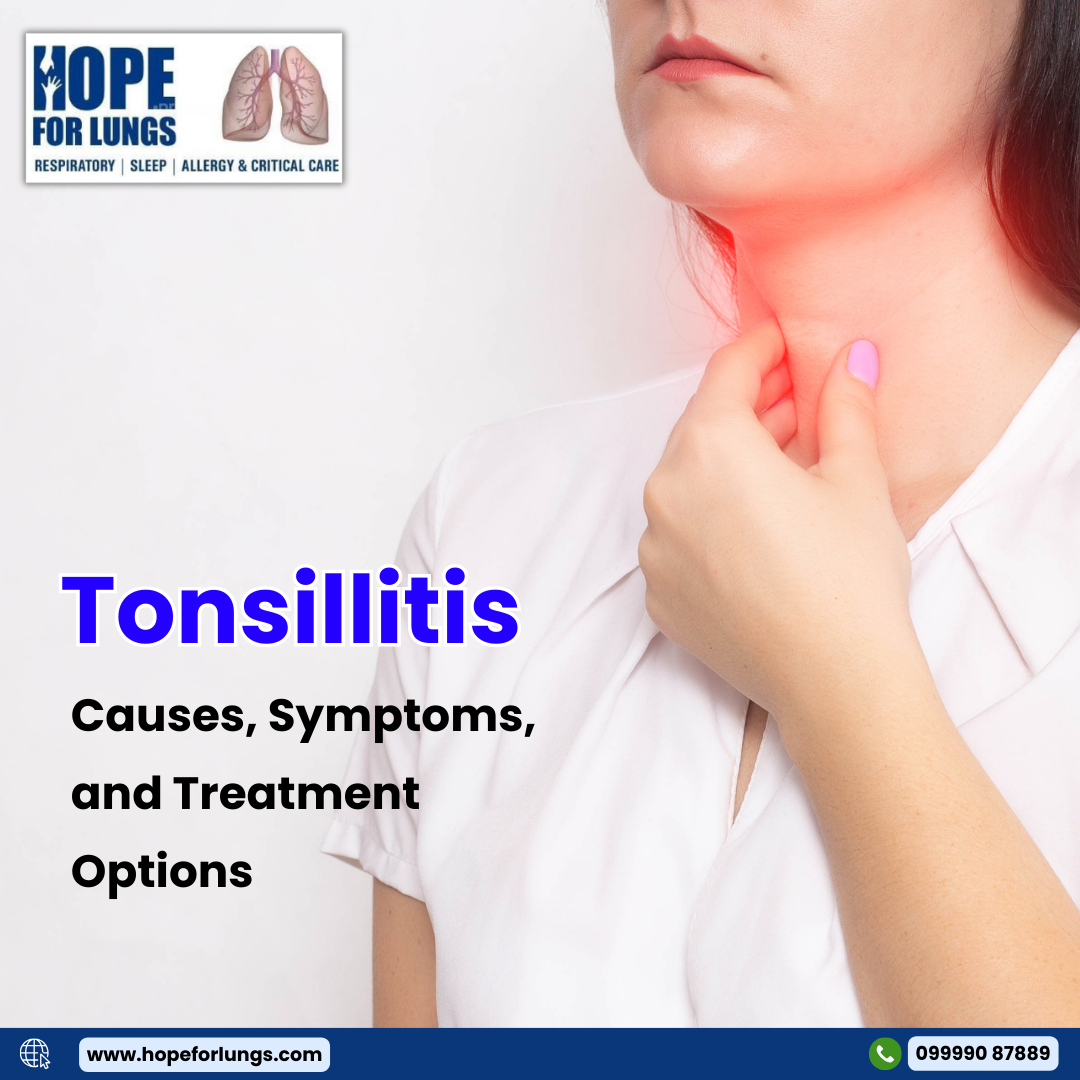 Tonsillitis